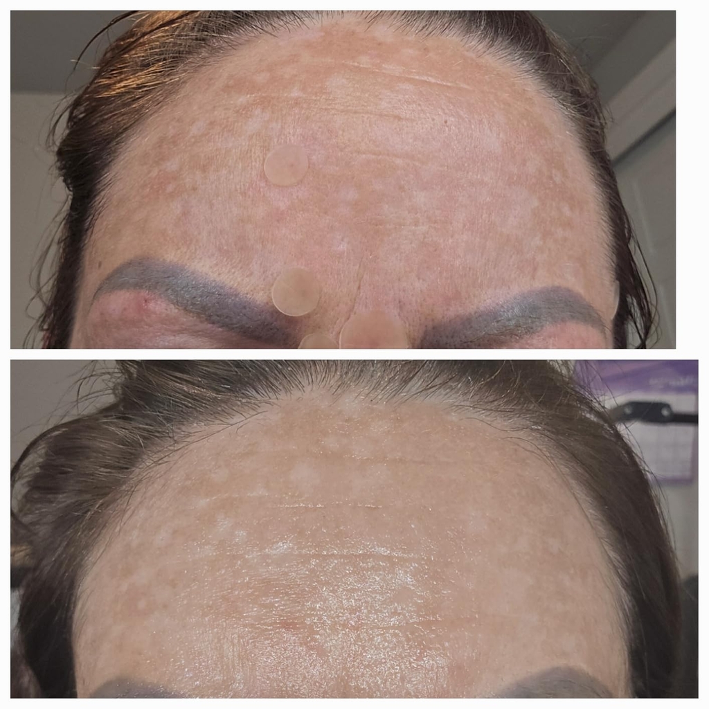 Skinovat™ Korean Skin Rewind Cream